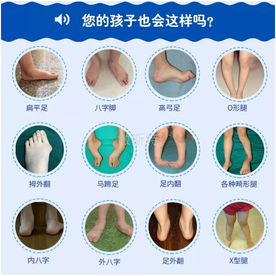 耐樂途功能鞋 關注兒童足部健康